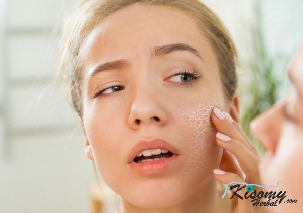 مزایای کرم مرطوب کننده آلوئه ورا